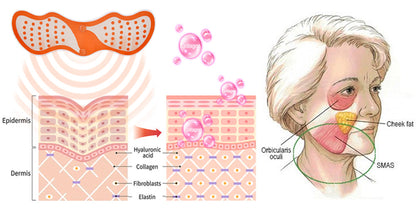 EMS Vshape Micro Current Massager